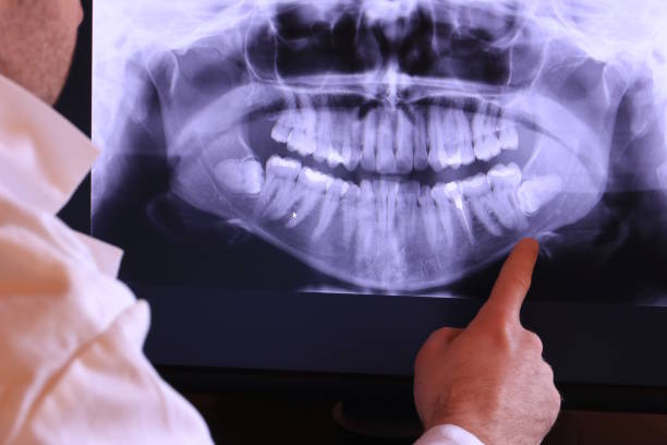 Best Emergency Dental Extractions in Century, FL