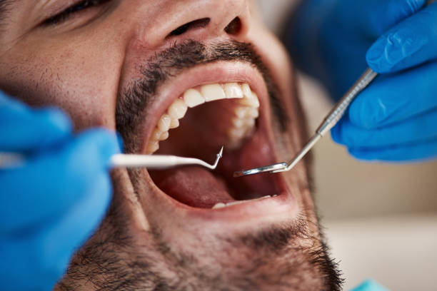 Best Mobile Emergency Dentist in Century, FL